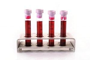 How to Read Your Liver Blood Test Results (Please read) - Part 1